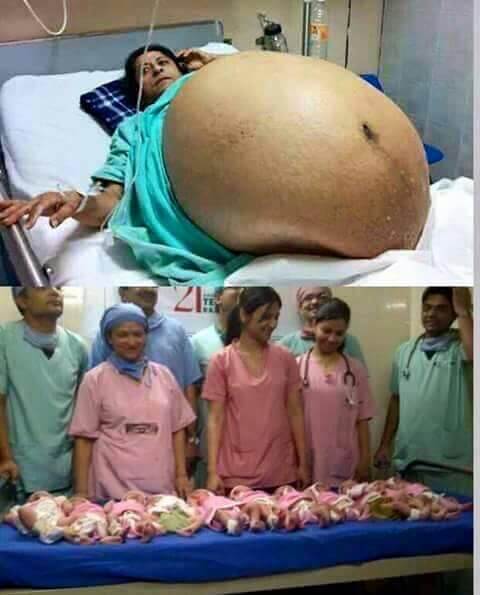 Women Giving Birth To 11 Babies