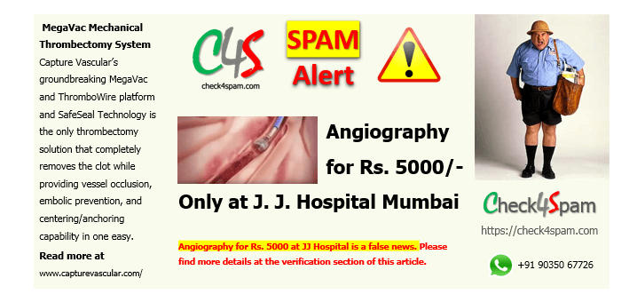 Angiography for Rs. 5000 at JJ Hospital Hoax